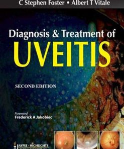 Diagnosis and Treatment of Uveitis 2nd Edition C Stephen Foster Md  Facs