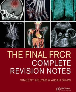 The Final FRCR Complete Revision Notes 1st Edition Vincent Helyar